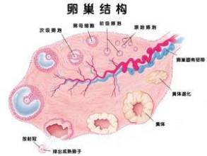 多囊卵巢综合症
