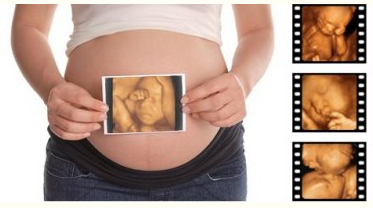 贵阳心脏彩超医院